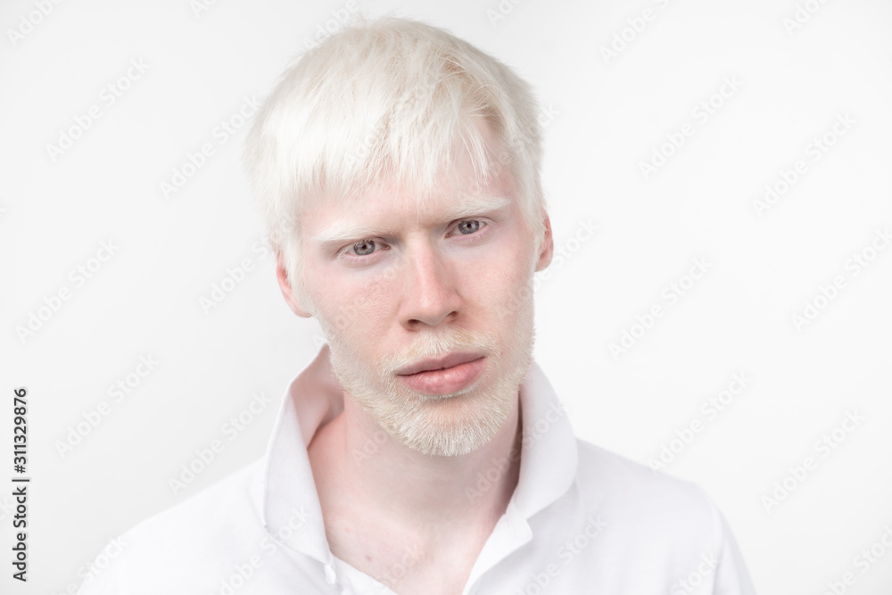 portrait of an albino man in studio dressed t-shirt isolated on a white background. abnormal deviations. unusual appearance portrait of an albino man in studio dressed t-shirt isolated on a white background. abnormal deviations. unusual appearance