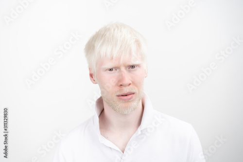 portrait of an albino man in studio dressed t-shirt isolated on a white background. abnormal deviations. unusual appearance