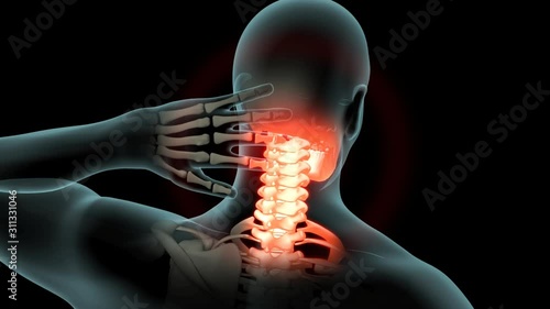 Neck Pain
