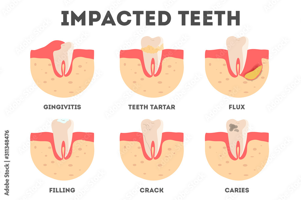 types of oral diseases