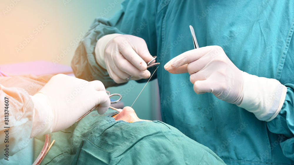 The doctor is sewing the rhinoplasty in the operating room. The doctor is sewing the rhinoplasty in the operating room.