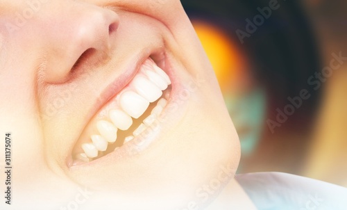 Odontology periodontal attractive teenager beautiful girl bleaching