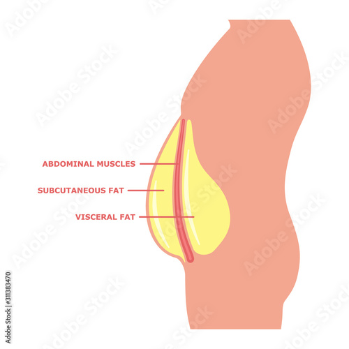 Visceral fat in a male body isolated on white