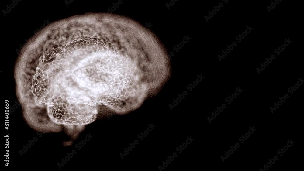 Magnetic resonance video of human brain over black background. Magnetic resonance video of human brain over black background.