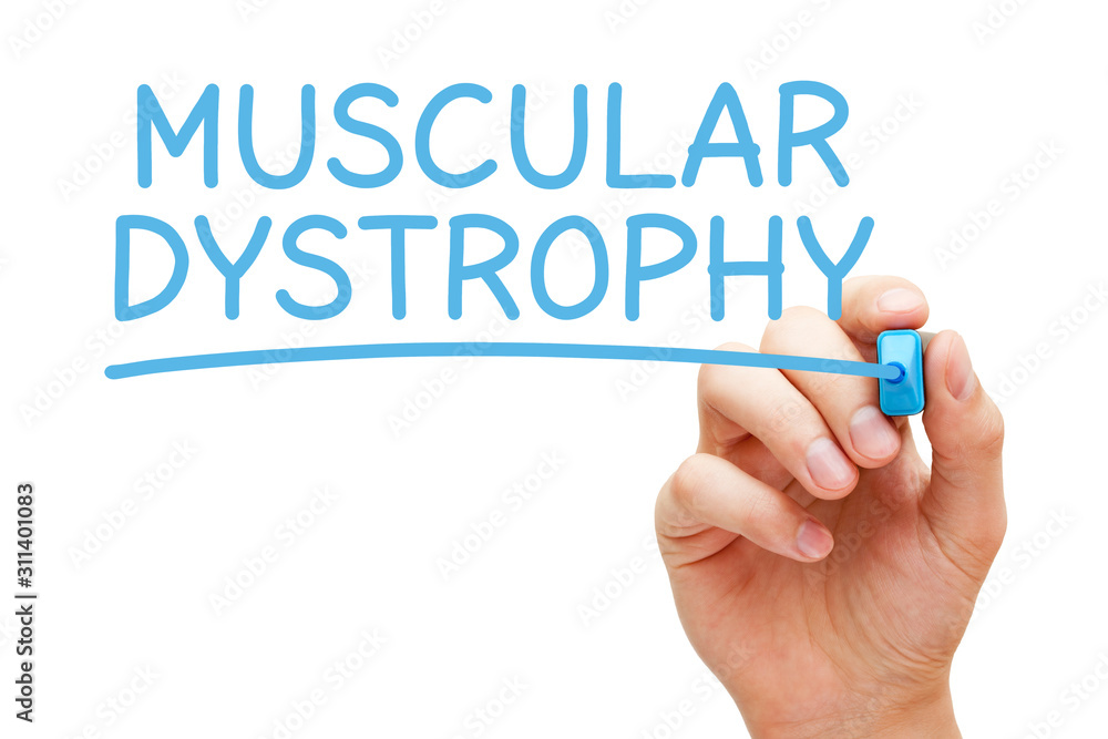 Muscular Dystrophy Handwritten With Blue Marker Muscular Dystrophy Handwritten With Blue Marker