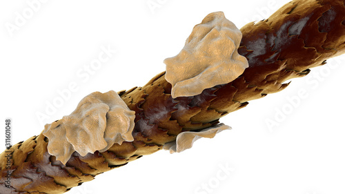 Fotografija Human hair with dandruff isolated on white background, close-up view, 3D illustr