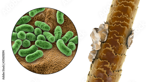 Human hair with dandruff and close-up view of microscopic fungi Malassezia furfur that cause dandruff and seborrhoeic dermatitis, 3D illustration photo