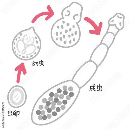 エキノコックス