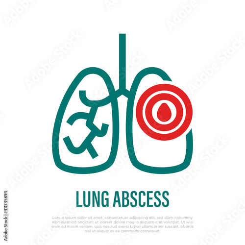 Lung abscess thin line icon. Pus pocket in lungs. Inflammation and pain. Vector illustration.