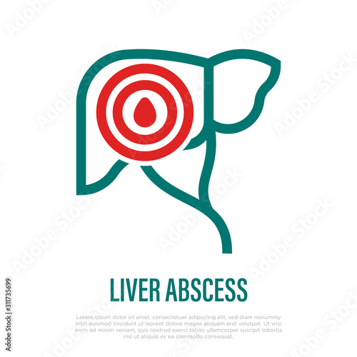 Liver abscess thin line icon. Inflammation and acute pain in abdomen. Mass with pus. Vector illustration.