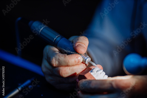 A dental technician processes a cast.