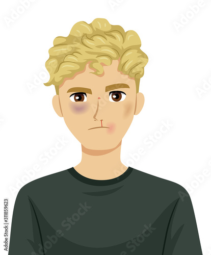 Teen Boy Fight Bruises Illustration