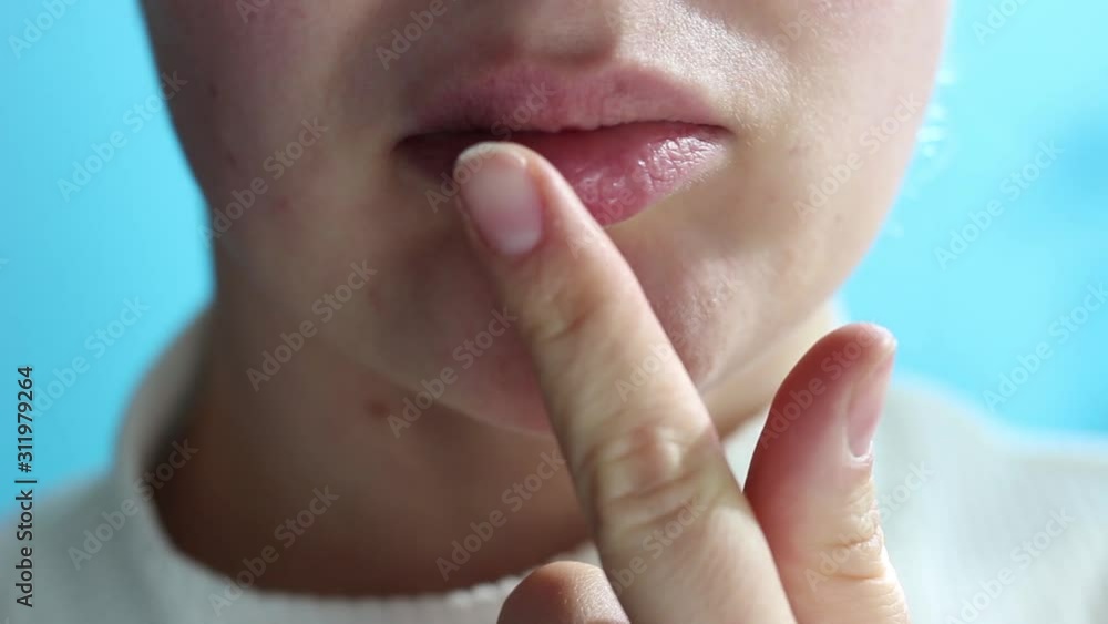 Female hand smears herpes ointment on lips, front view close-up Female hand smears herpes ointment on lips, front view close-up