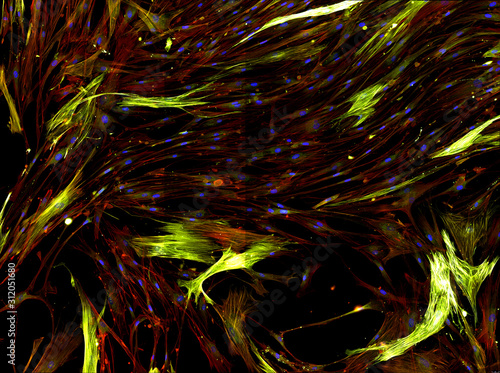 Real fluorescence microscopic view of human cells - human lung fibroblasts