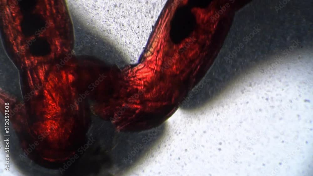 Transparent body of the worm with the bodies under microscope in motion ...