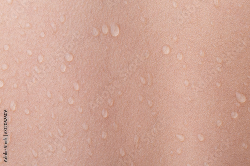 drops of water on human skin