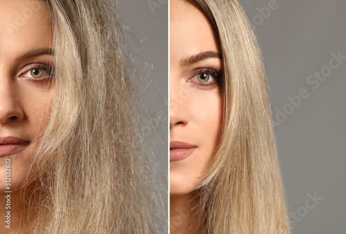 Woman before and after hair treatment on grey background photo