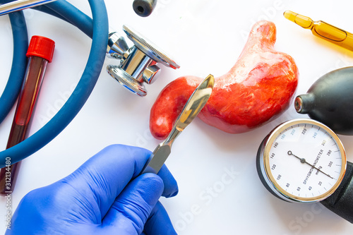 Tableau sur toile Concept photo of stomach or gastric surgery