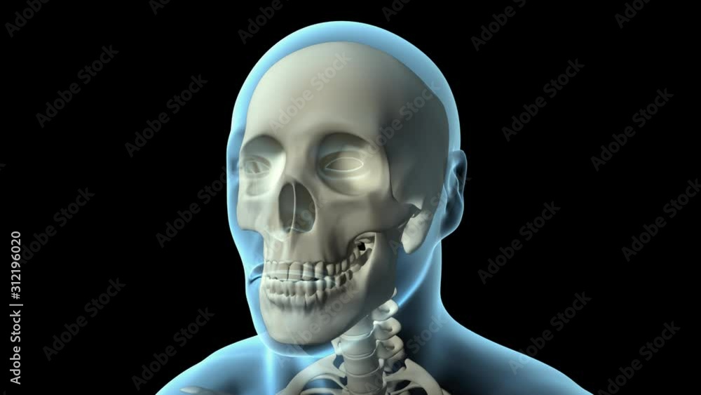 Cluster Headache Cluster Headache