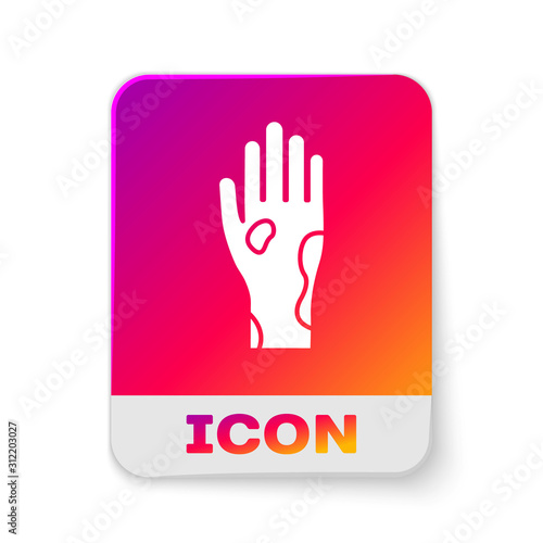 White Hand with psoriasis or eczema icon isolated on white background. Concept of human skin response to allergen or chronic body problem. Rectangle color button. Vector Illustration