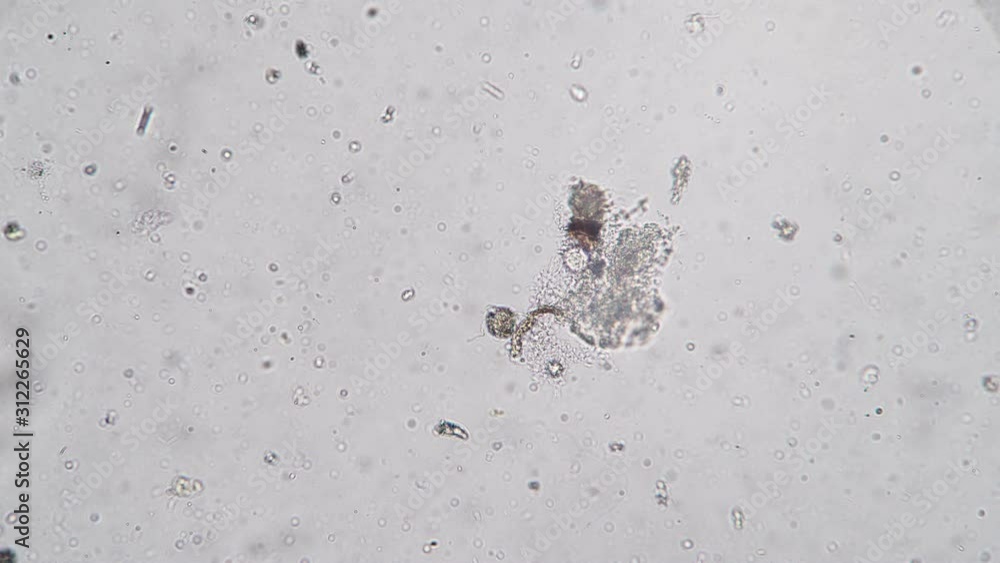 Water filled with bacteria and protozoa microcosm background. Theme of laboratory biological research under microscope. Microscopic protozoa in a drop of water magnification. Life of microorganisms. Water filled with bacteria and protozoa microcosm background. Theme of laboratory biological research under microscope. Microscopic protozoa in a drop of water magnification. Life of microorganisms.