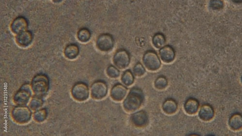 Microscopy of yeast cells (Saccharomyces cerevisiae). Magnification 900x with visible cells of granule shape. 