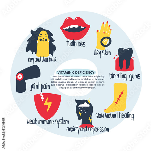 Hand drawn vitamin C ascorbic acid deficiency: dry skin, hair, joint pain, tooth loss, bleeding gums, weak immunity system, depression. Vector illustration is for pharmacological or medical poster