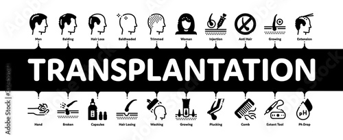 Hair Transplantation Minimal Infographic Web Banner Vector. Balding And Baldness Man Head, Shampoo And Medicine In Bottle Transplantation Concept Illustrations