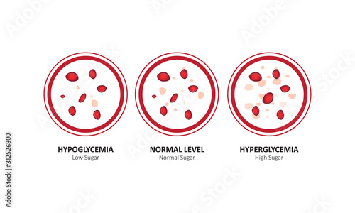 Glucose blood level sugar test. vector illustration