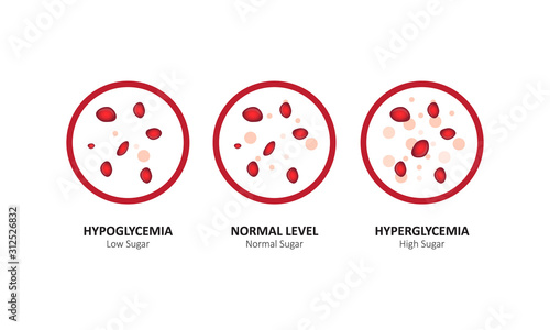 Glucose blood level sugar test. vector illustration