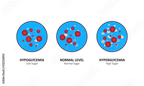 Glucose blood level sugar test. vector illustration