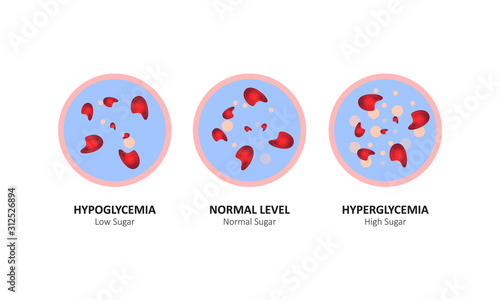 Glucose blood level sugar test. vector illustration