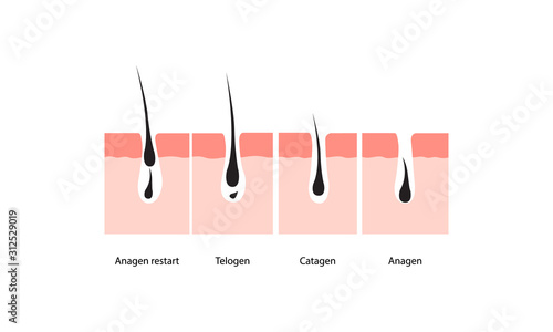 Hair growth cycle skin. vector illustration