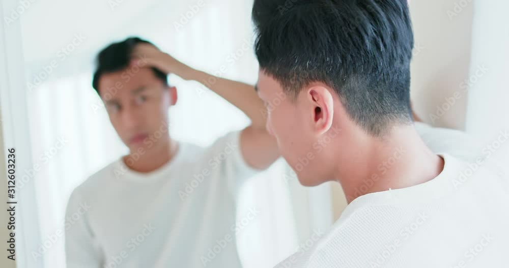 man worried for hair loss man worried for hair loss