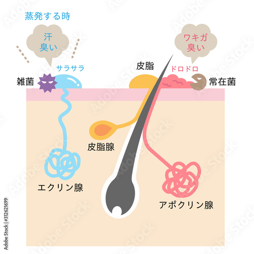 体臭の原因と汗腺　肌の断面図