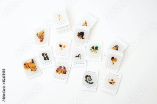 Foto Paraffin Embedded Tissue Blocks of Cancer on iSolated White Background