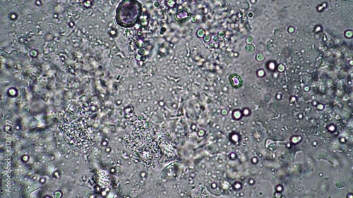 Lactic acid bacilli in leaven from milk under a microscope. Microcosmic background. The theme of lactic acid foods is under 1000x magnification. Bacteria useful for the human body from yogurt. photo