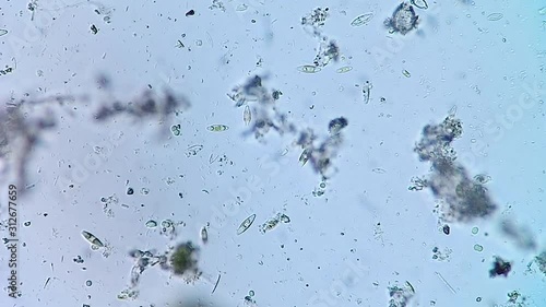 Living diatoms in benthic pond water photo