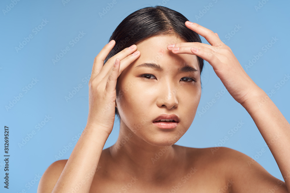 young woman with headache