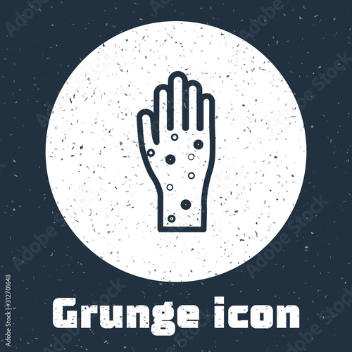 Grunge line Hand with psoriasis or eczema icon isolated on grey background. Concept of human skin response to allergen or chronic body problem. Monochrome vintage drawing. Vector Illustration