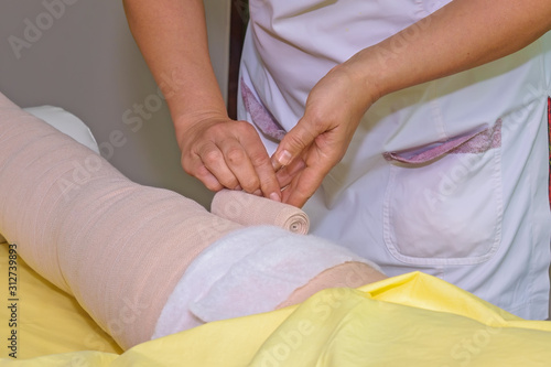 Lymphedema management: Wrapping leg using multilayer bandages to control Lymphedema. Part of complete decongestive therapy (cdt) and manual lymphatic drainage (MLD) photo