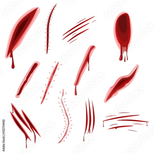 Graphic realistic wound set with blood splash isolated on white background. Many traumatic painful cut scar surgical stitch and damage of skin design vector illustration