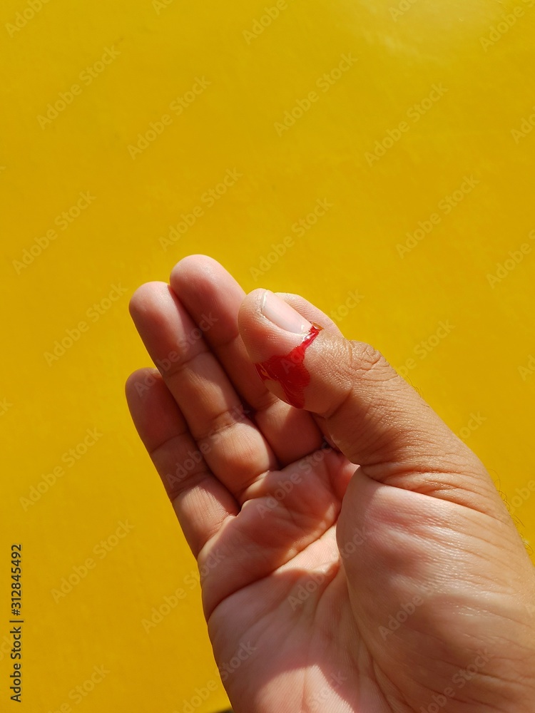 The man's hand had a wound from a knife with a blushing blood on a yellow background. The man's hand had a wound from a knife with a blushing blood on a yellow background.