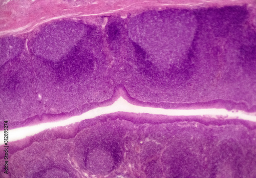 Palatine tonsil cross-section of a domestic cat (Felis catus Linnaeus, 1758) - permanent microscope slide (stained by haematoxylin-eosin)