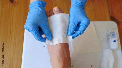 Nurse is putting antiseptic dressing at the wounded foot