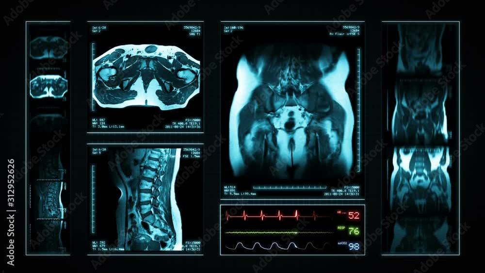 Pelvis MRI Scan. Blue. 4 videos in 1 file. Animation showing top, front,  lateral view and ECG display. Each video is loopable. Medical Background.  More options in my portfolio. Stock Video | Adobe Stock
