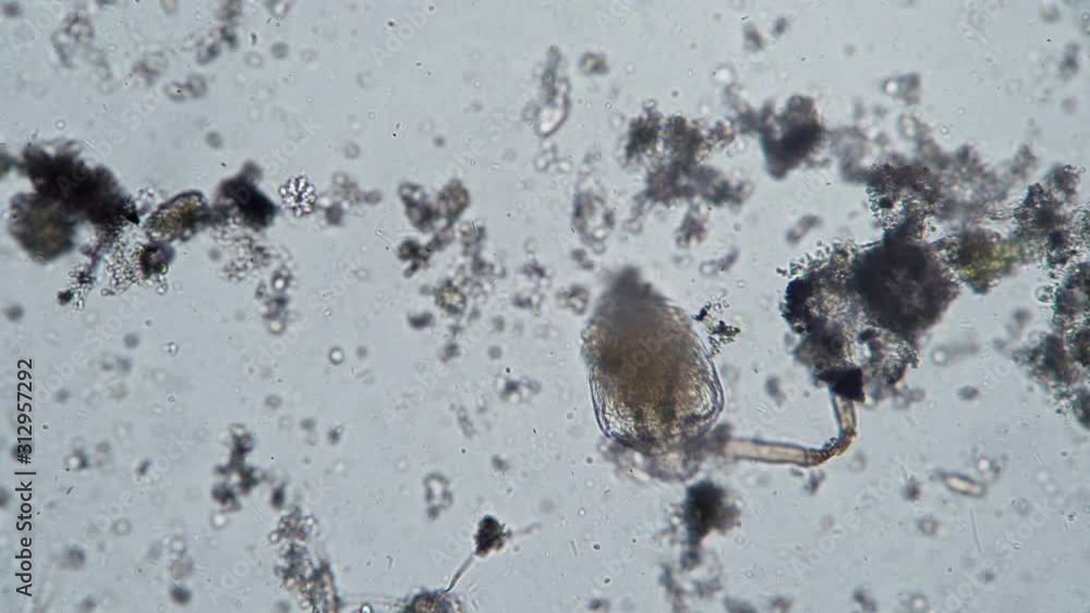 Vidéo Stock Big rotifer close-up in dirty water microscopic background ...