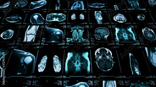 MRI video wall. Black and white. Loopable. Frontal view. 2 videos in 1 file. Composite video showing multiple MRI images including: head, neck, arm, foot, pelvis, etc. More options in my portfolio.      photo