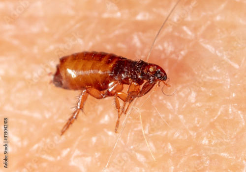 Flea on human skin