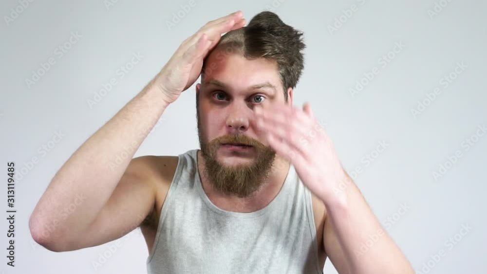 The man touched his bald head in the mirror.Before after The man touched his bald head in the mirror.Before after